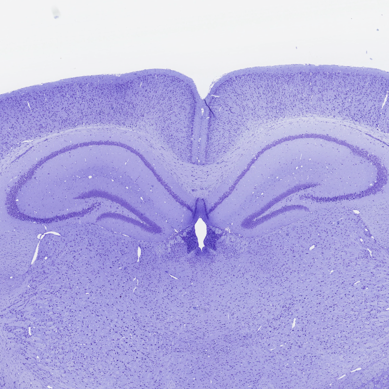 Mouse brain