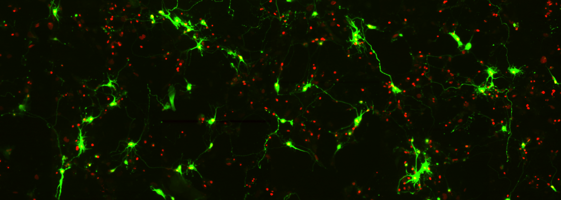 Neurons